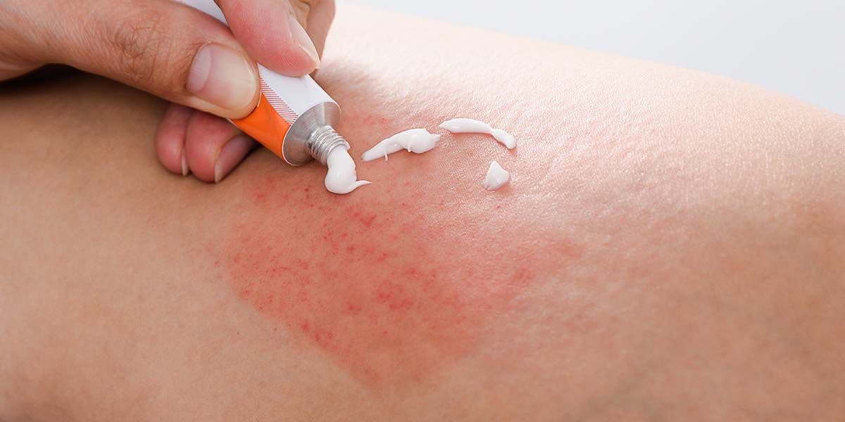 Skin conditions clinic consultation